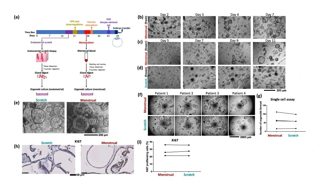 Endometrial Organoid Research Diagram